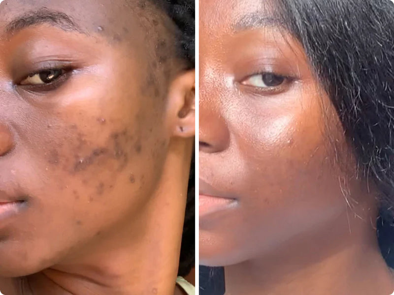 Customer result